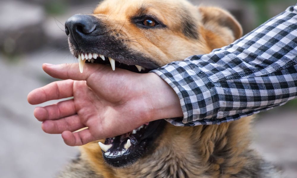 man getting a dog bite in San Antonio, TX