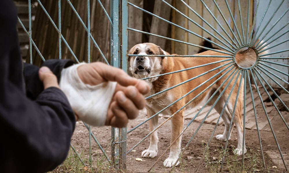man after a dog bite in San Antonio, TX